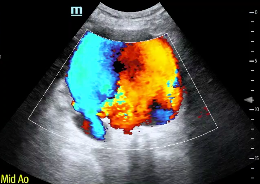 Ultradound image
