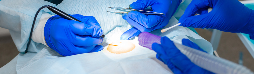 image of surgeons removing skin cancer