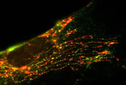 Mitochondrial