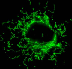 Mitochondrial