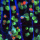 Endothelin Signaling in Glaucomatous Neurodegeneration
