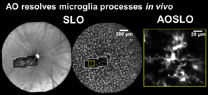 ao_microglia_processes