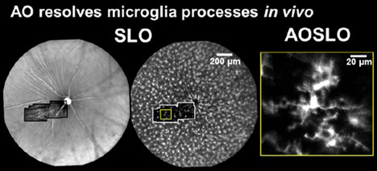 microglial cells in retina
