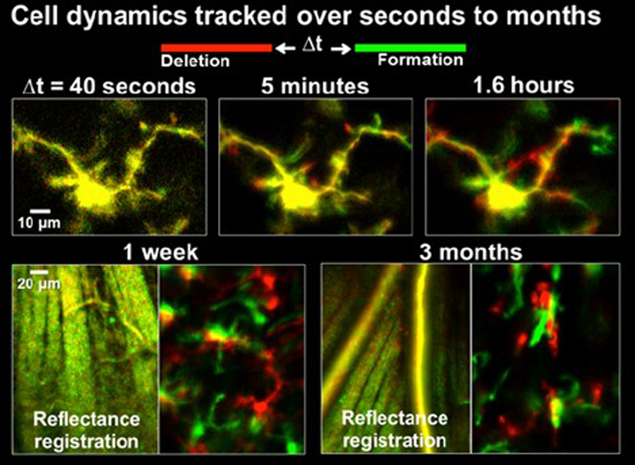 microglial cells tracking