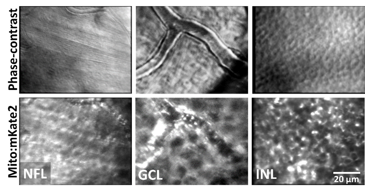 High-resolution AOSLO imaging