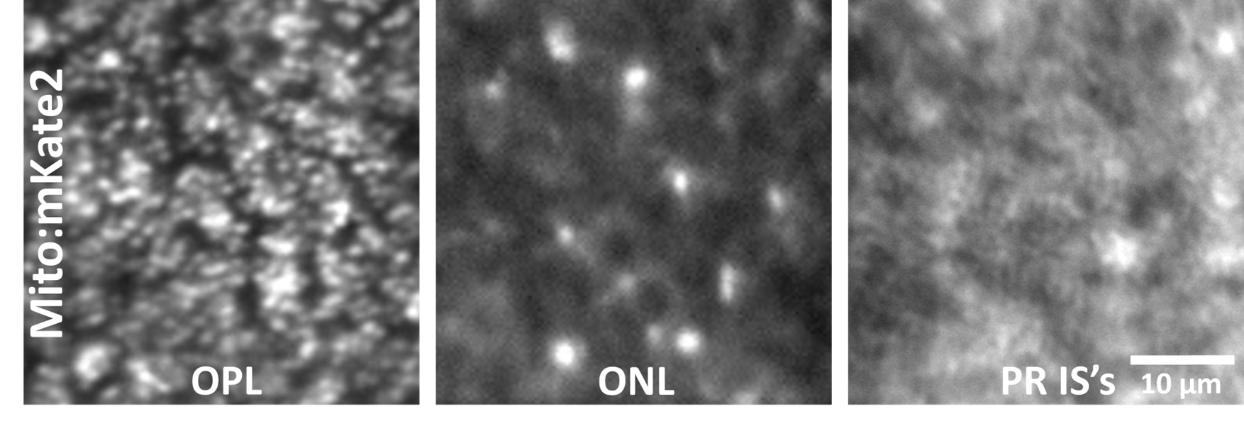 distinct mitochondrial patterns were observed throughout the photoreceptor layers