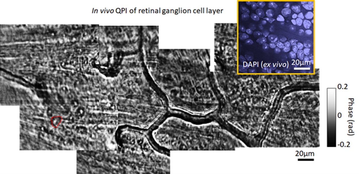 in vivo QPI of retinal ganglion cell layer