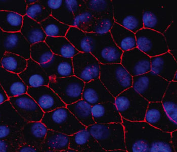 Photo of Human induced pluripotent stem cell-retinal pigment epithelium in a dish