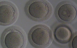 Oocytes at different stages Sperm photos | Dr N Layyous