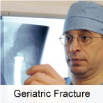 Geriatric Fracture Center at Highland Hospital, Rochester, NY
