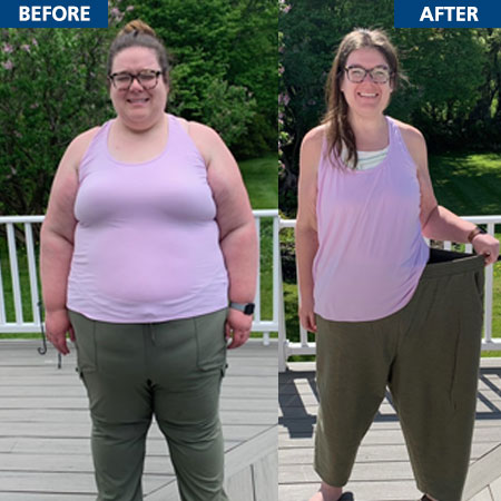 Bariatric Surgery results