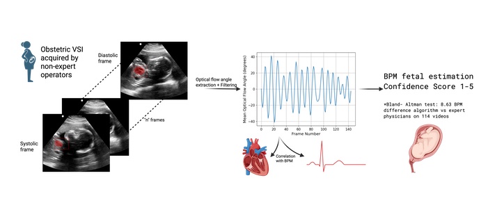 Fetal Heart Rate