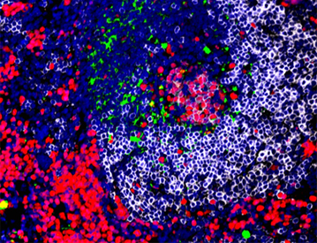 Reduction of germinal center in lupus prone mice after treatment with a small inhibitor of nuclear export KPT-350