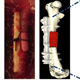 Bone Regeneration and Infection Management using 3D Printed Scaffolds