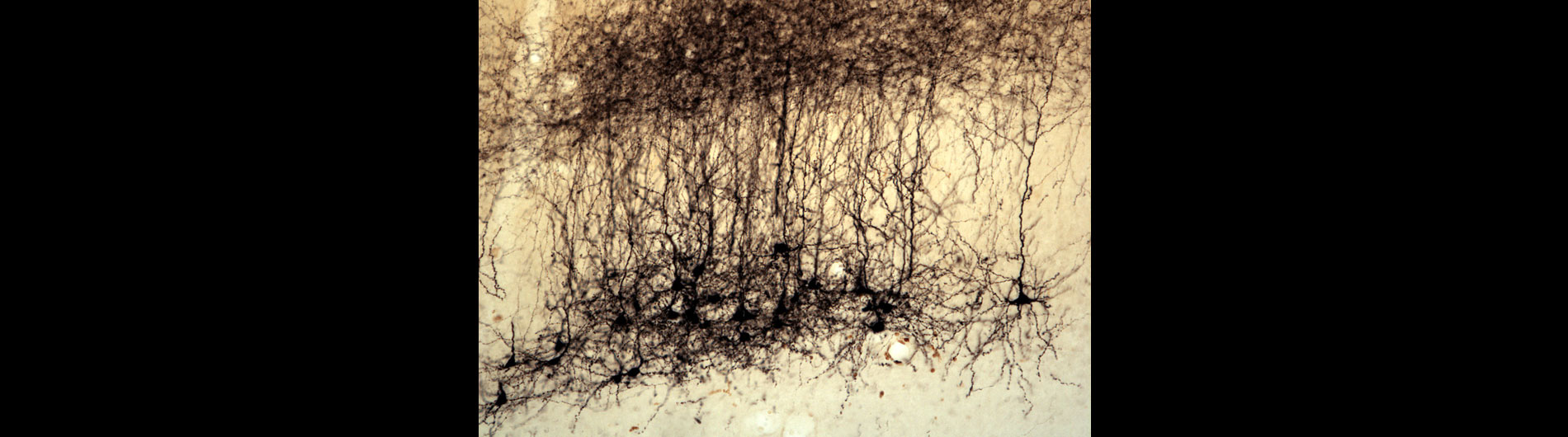 Briggs Lab - Histology Neurons