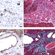 Investigating the mechanisms of pancreatic cancer dormancy