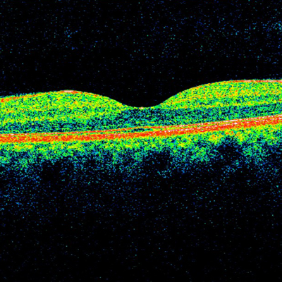 eye scan of side view of eye
