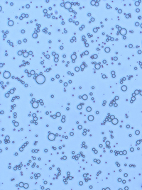 Microscopic image of microbubble contrast agents