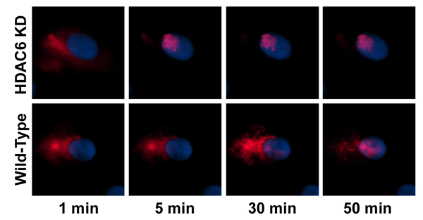 Images of of HDAC6