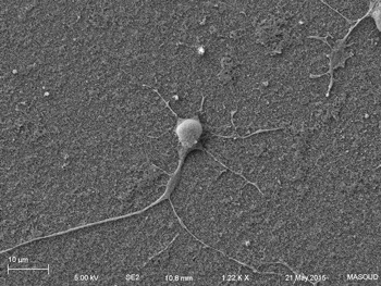 Human primary neuron growing on carbon nanotube array