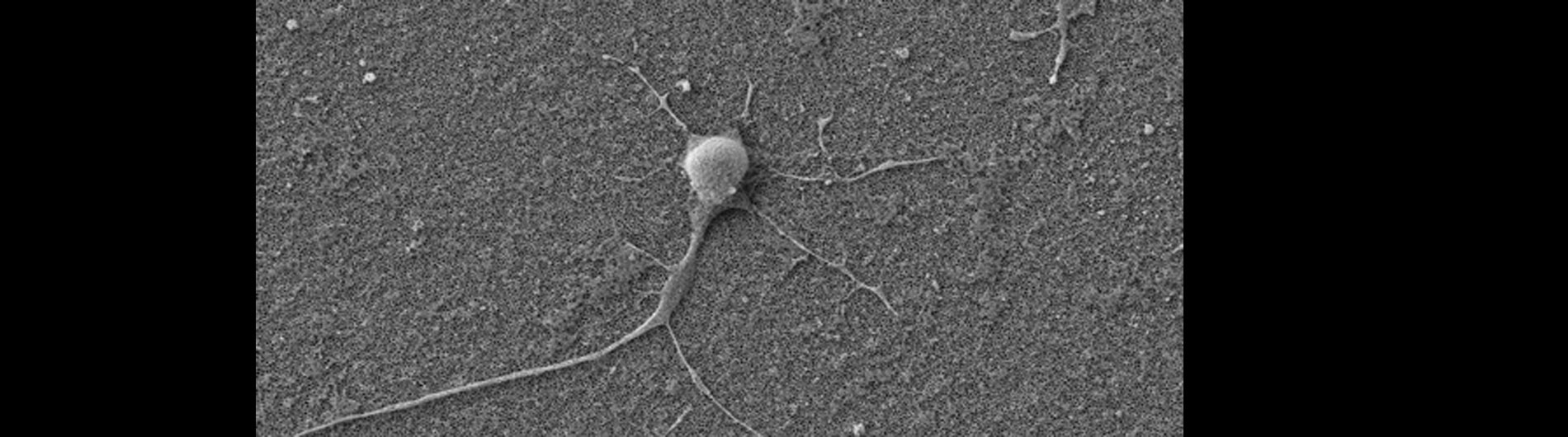 Dickerson Research - Neuron