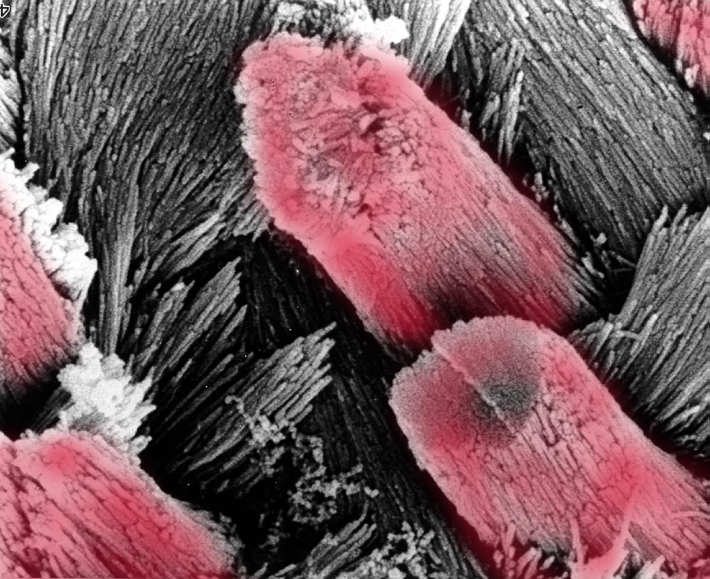 Regularly spaced red-stained crystalline columns angle to the left between flaky white crystals angled to the right.