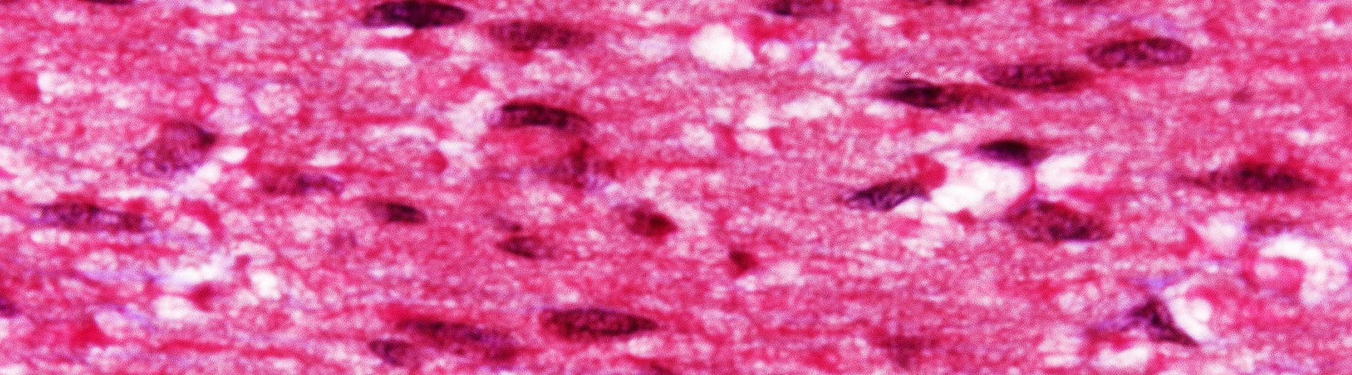 diekwisch-banner-web.jpg View of trigeminal nerves under a microscope.