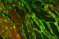 Multi-photon laser scanning fluorescence microscopy view of tumor vessels