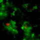 image of florescent t-cells