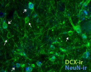 Microscopic image of immature neurons