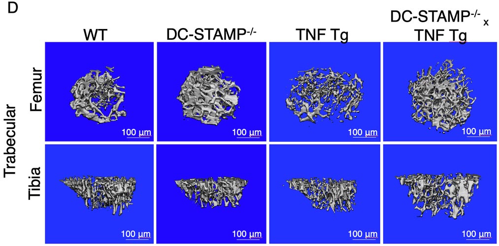 Bone density, TNF Tg mice and DC-STAMP-/-x TNF Tg mice