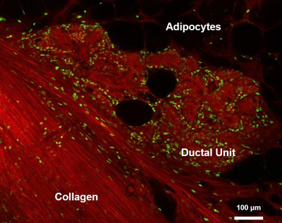 Breast Tissue