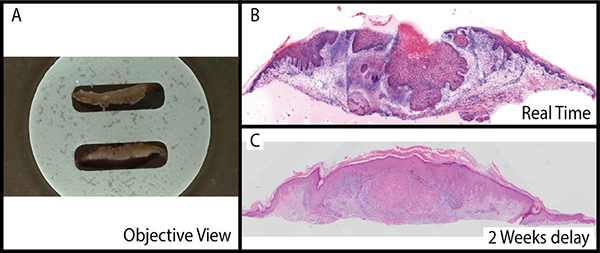 Multiphoton Skin Biopsy Objective View, Real Time View, and 2 Weeks Delay View