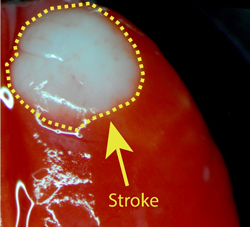 Photothrombotic stroke as measured by TTC staining