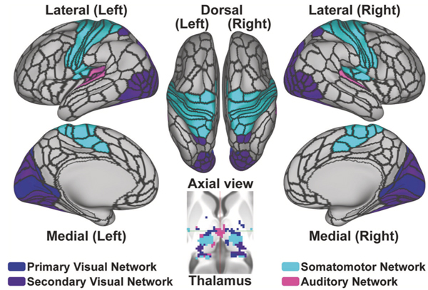 Keane lab project Establishing a novel somato-visual biomarker for psychotic disorders