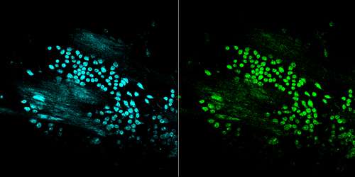CFP and YFP images of cells in the Cremaster venule of live mouse.