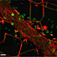image of inflamed neurons