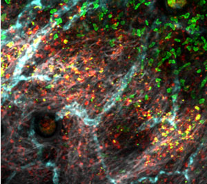 Image of florescent t-cells