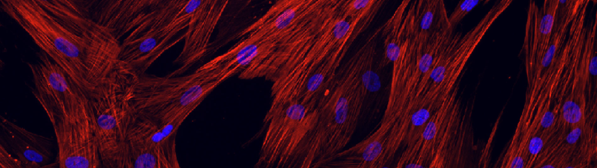 Myofibroblasts stained for α-smooth muscle actin (red) with immunofluorescence staining
