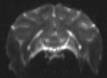 Monkey brain phased array coil