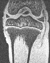 MRI of rabbit knee