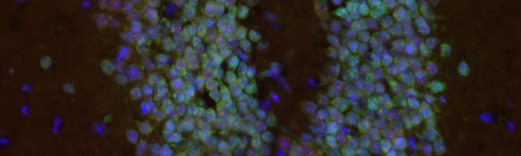 Microscopic view of glowing blue and green cells densely packed, scattered against a dark background, resembling bioluminescent clusters
