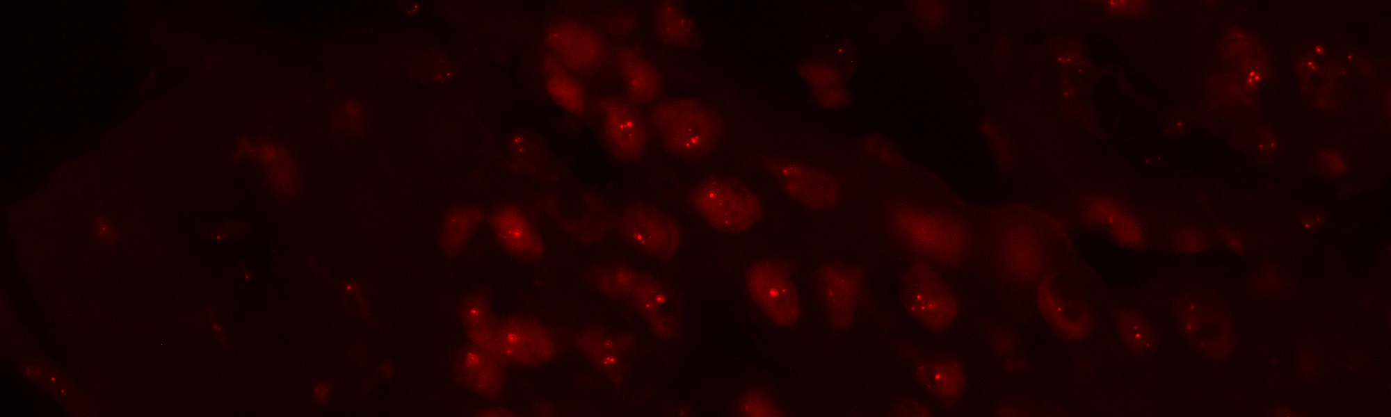 Vibrant red cells through the darkness