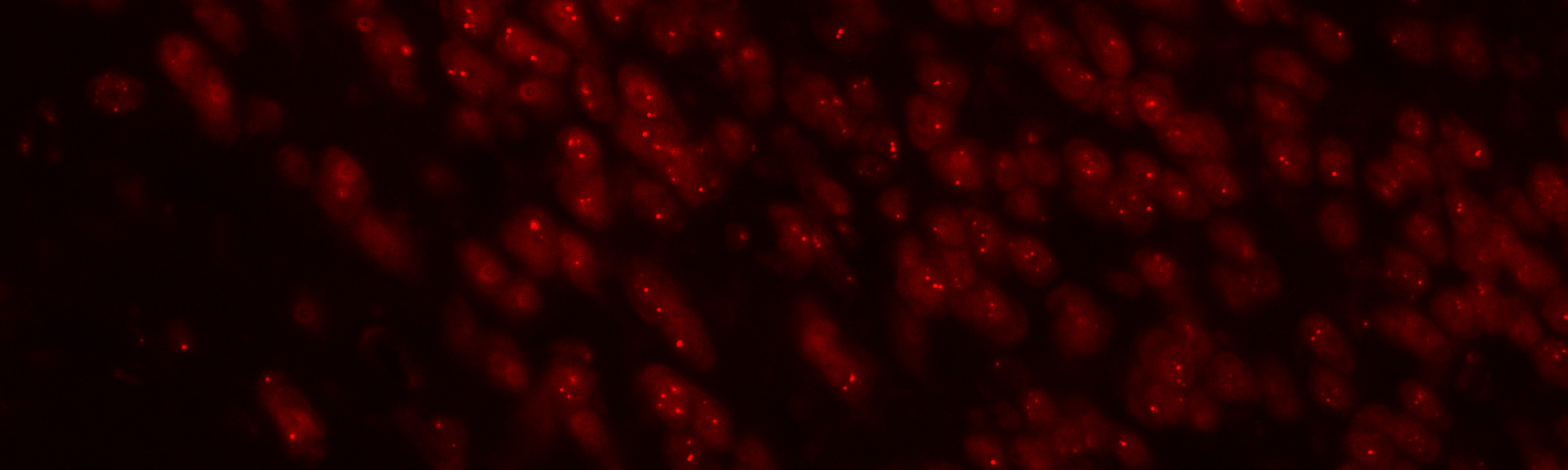 Microscope view of cells illuminated by red light, showcasing their structure and details.
