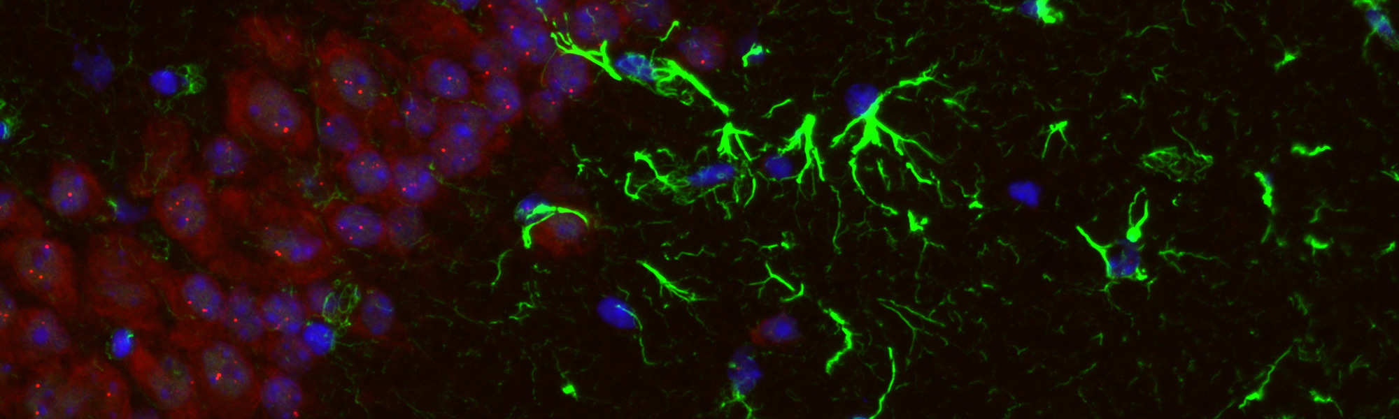 Microscopic view of a green and red cell illuminated by blue light, showcasing cellular structures and colors