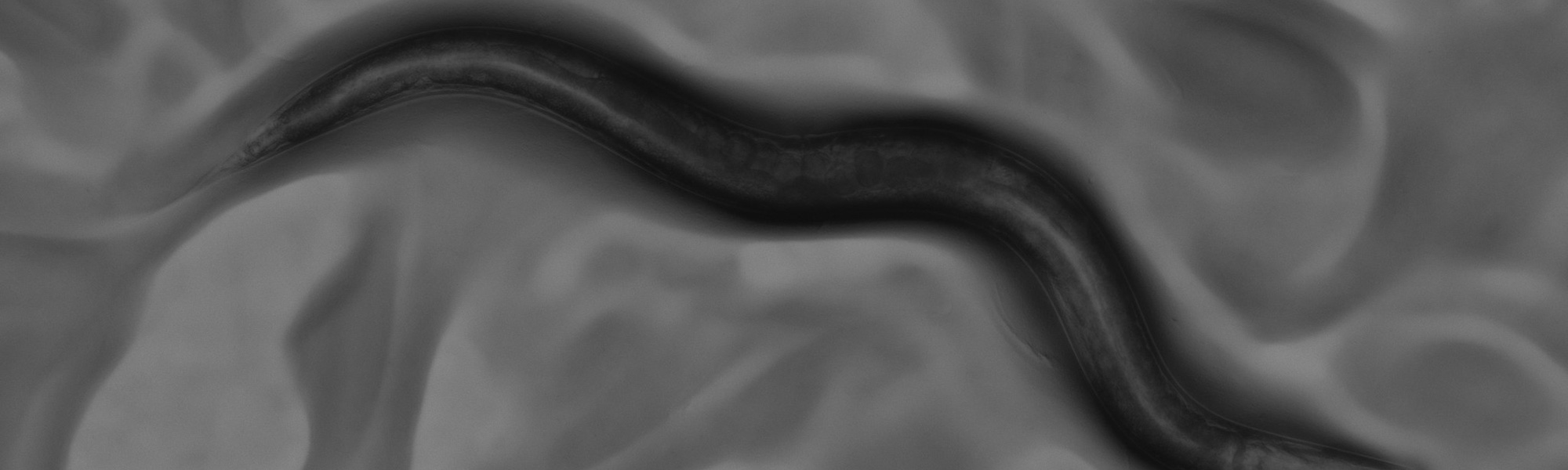Black and white microscope image showing cells arranged in a curved wave pattern