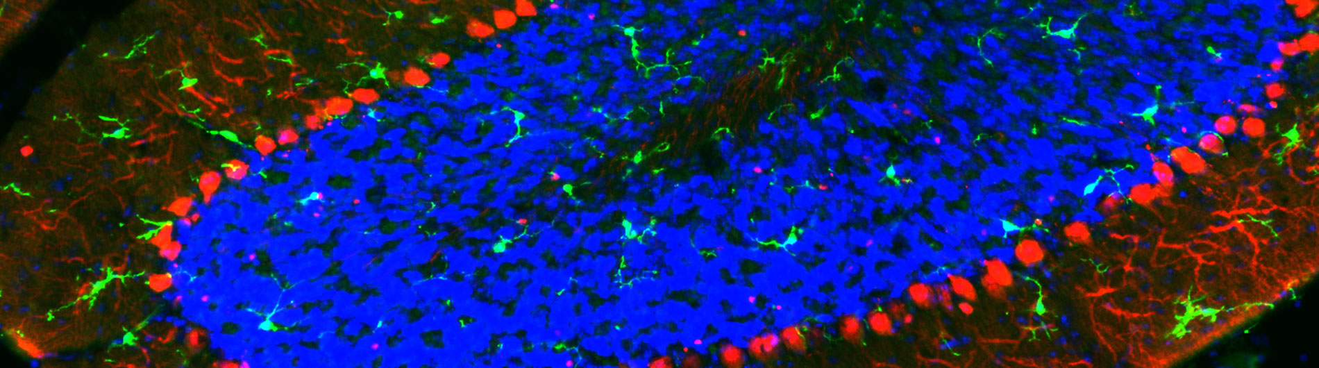 Florescent labeled region of brain