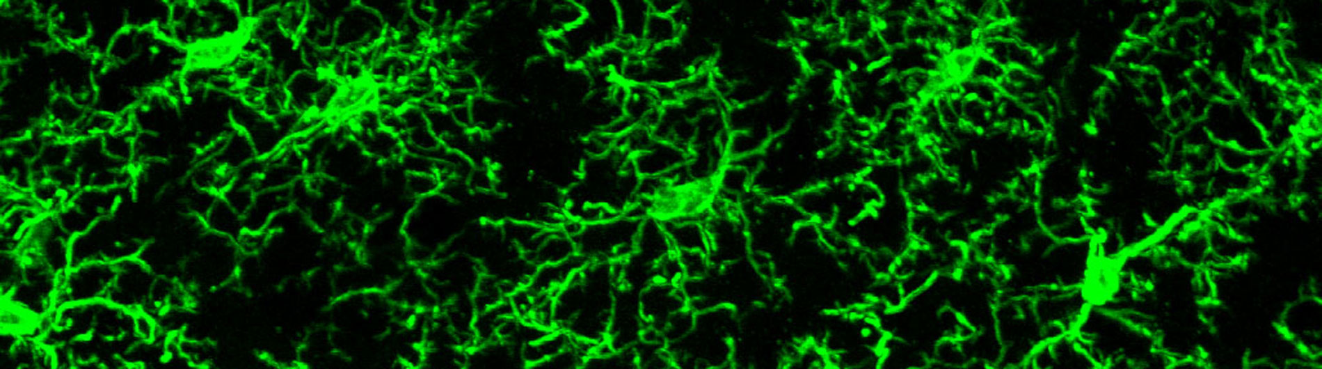 Florescent labeled Neurons