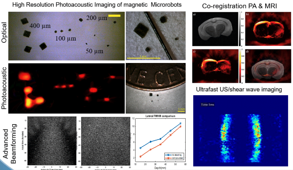 photoacoustic imaging