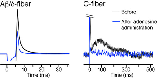 Graph of transmission rates through nerve fibers